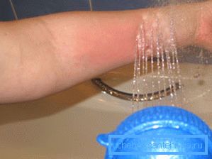Håndter behandling med hydromassasjeapparat Håndter behandling med hydromassasjeapparat